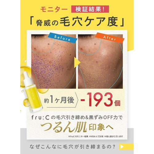 fru:C Vitamin C Serum - Pore-Refining Formula, Amazon Limited Edition - image 3